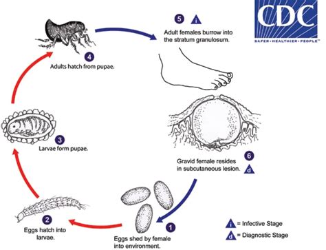 cdc tungiasis.